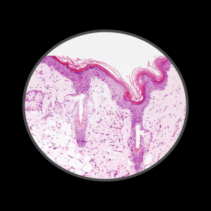 histopatologia