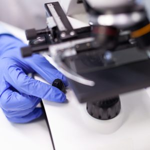 Close-up of doctor woman hands analyzing microbiology disease test results using medical microscope. Specialist researcher working at pharmaceutical expertise in pharmaceutical hospital laboratory